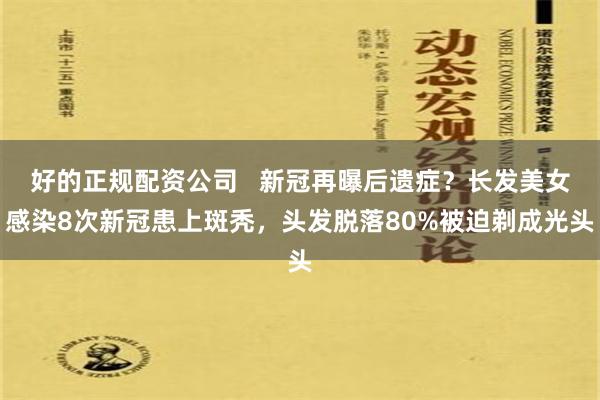 好的正规配资公司   新冠再曝后遗症？长发美女感染8次新冠患上斑秃，头发脱落80%被迫剃成光头